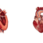 TAVI – Definition and Application