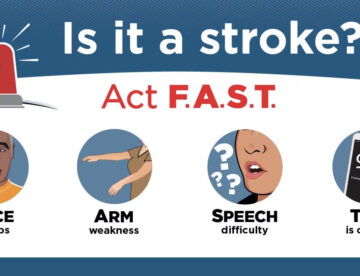FAST – Stroke Symptoms