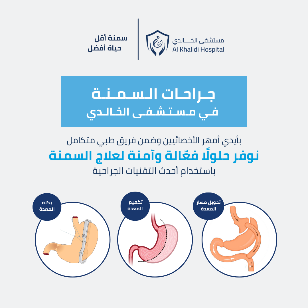 جراحات السمنة